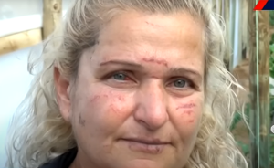 «ΣΕ ΠΑΡΑΚΑΛΩ, ΜΗΝ ΜΕ ΣΚΟΤΩΝΕΙΣ»!!! Η 50χρονη Ελληνίδα ΔΕΙΧΝΕΙ τι της έκανε ο ΠΑΚΙΣΤΑΝΟΣ ΒΙΑΣΤΗΣ, vid