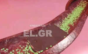 «ΠΟΤΕ ΞΑΝΑ τέτοιοι θρόμβοι αίματος»! Γιατρός δείχνει, εξηγεί και σοκάρει – ΒΙΝΤΕΟ