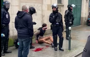 Αίμα στον δρόμο: Γάλλοι αστυνομικοί χτυπούν βάναυσα ψαράδες και άλλους διαδηλωτές – ΒΙΝΤΕΟ