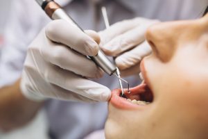 Dentist Pass: Περισσότερες από 86.000 αιτήσεις τις πρώτες 15 ημέρες