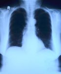 x-ray-image-568241_1280
