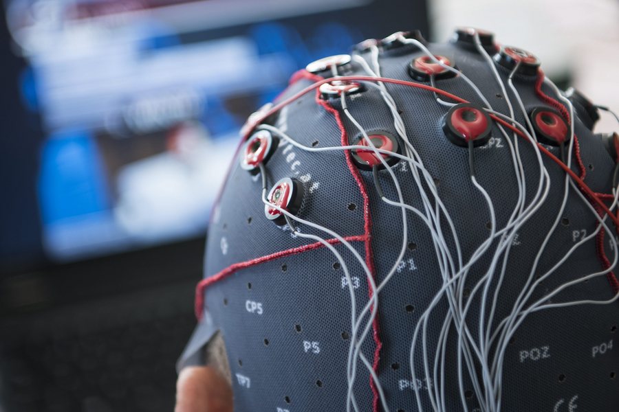 Εγκεφαλικά εμφυτεύματα: Η «ευρωπαϊκή απάντηση» στον Μασκ φέρνει εξελίξεις