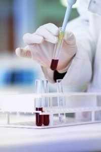O φρικτός θάνατος επιστήμονα από μία…σταγόνα – Μια τραγική ιστορία