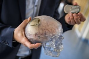 Άρχισε η μαζική διαφήμιση των εγκεφαλικών εμφυτευμάτων του Μασκ! Τι ακολουθεί; – ΒΙΝΤΕΟ