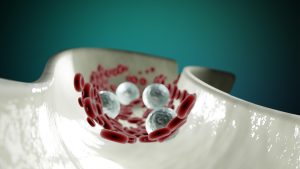 Ερευνητές λένε ότι ανέπτυξαν νέας γενιάς λεμφοκύτταρα που στοχεύουν “δύσκολους” συμπαγείς όγκους