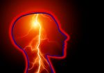 Stroke Epilepsy Seizure pixabay